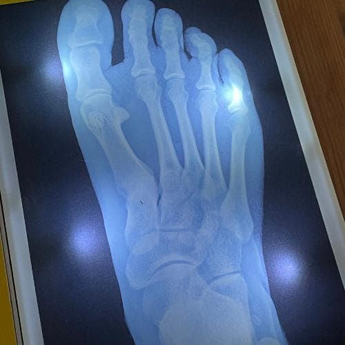 洋書【解剖学・骨格がわかる】レントゲン遊び　AMAZING X-RAYS　人体