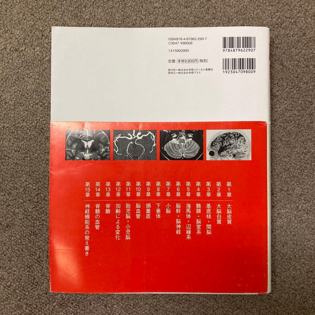 脳MRI 1(正常解剖)