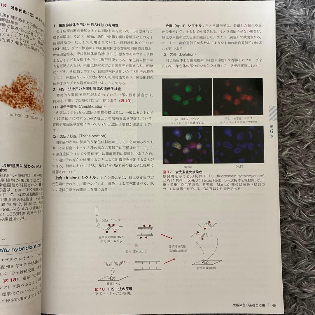 「ふろあー」 細胞診 鑑別 アトラス