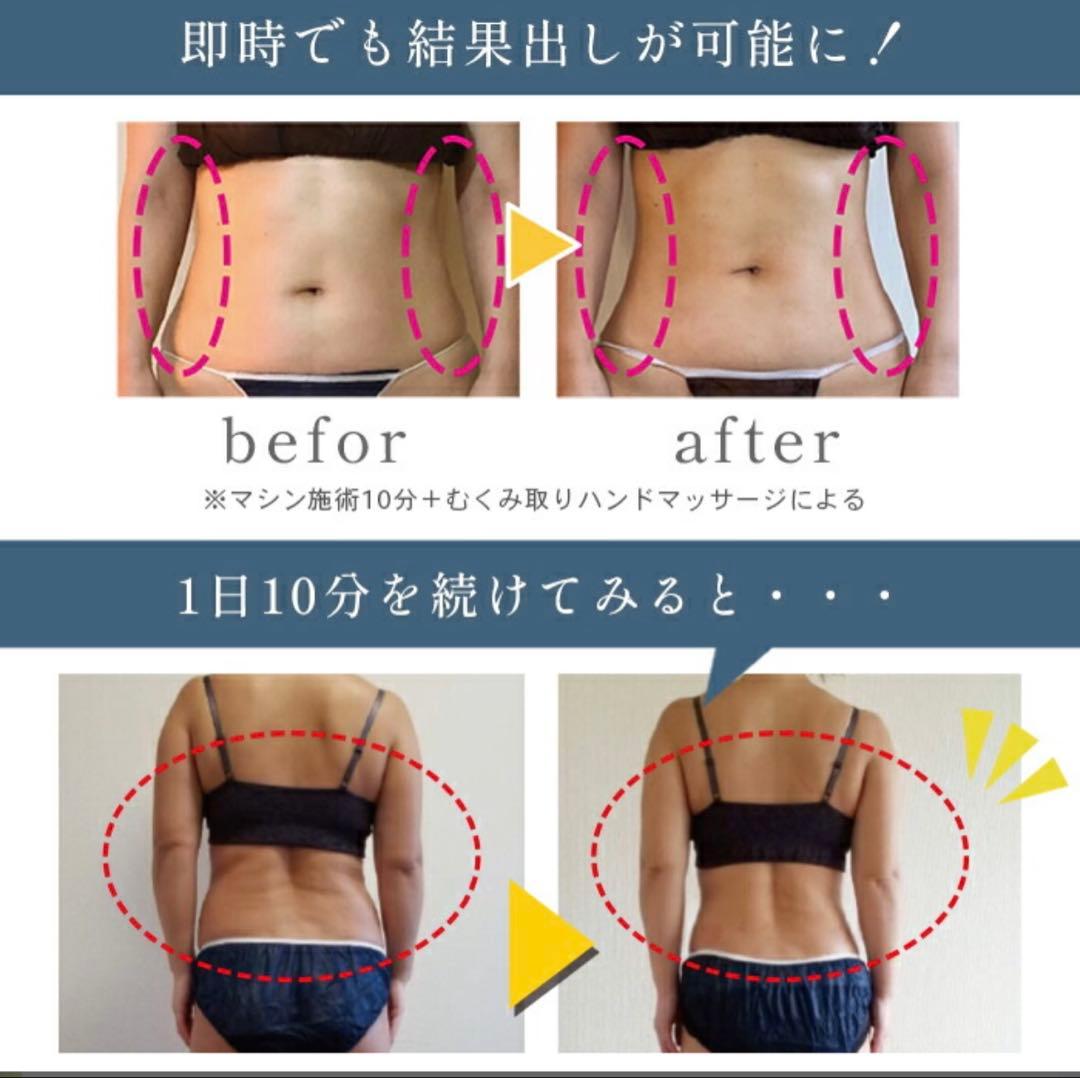 CAVI-R ONE+ PLUS キャビテーション ラジオ波 美顔器